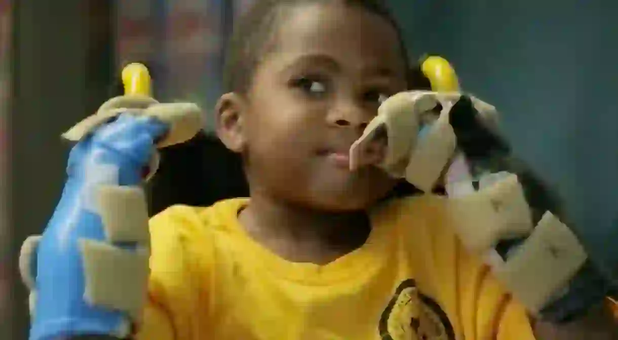 Zion Harvey, worlds first pediatric bilateral hand transplant recipient. (via The Childrens Hospital of Philadelphia/Youtube)